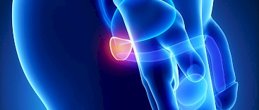 Symptome bei Erkrankungen der Prostata Beispielbild